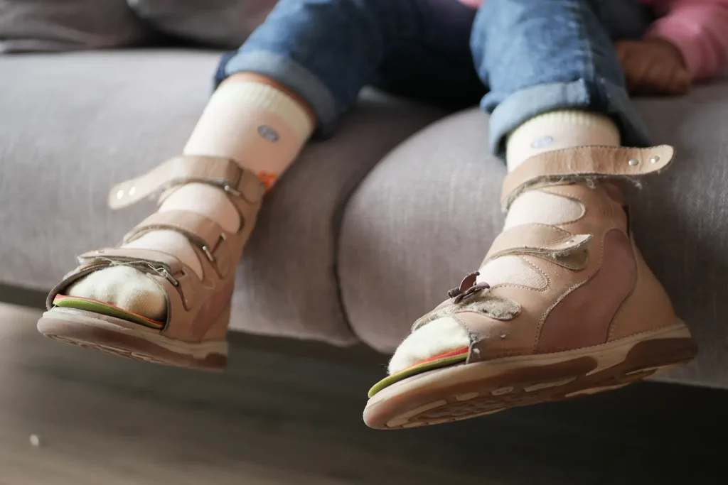 Incaltaminte Ortopedica versus Barefoot